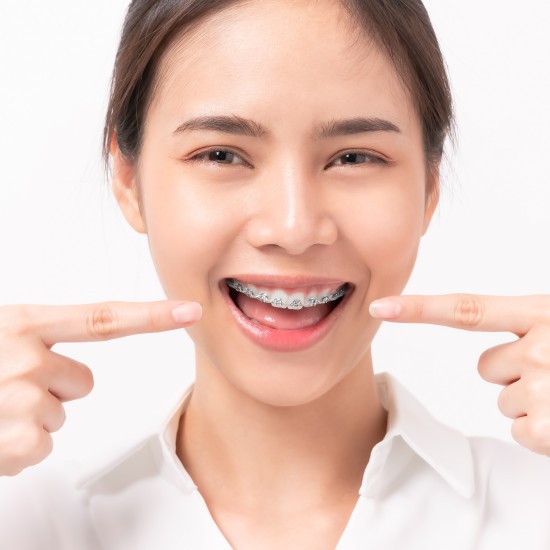 Niềng Răng Thẩm Mỹ
