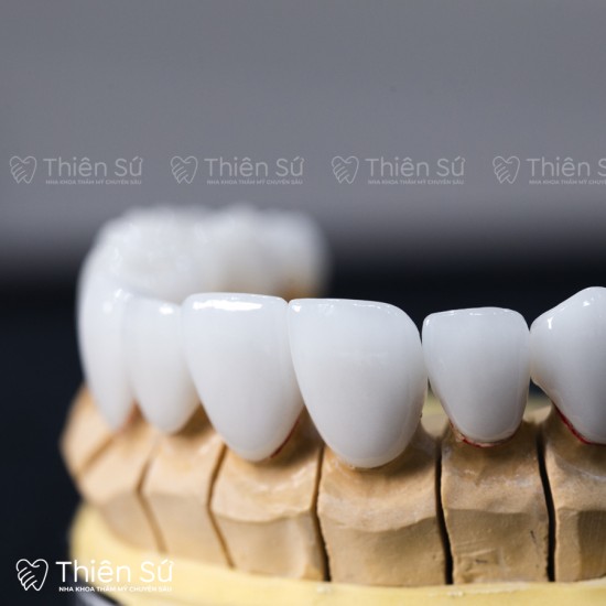 Răng Sứ Thẩm Mỹ