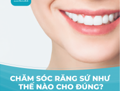 Chăm sóc răng sứ thế nào cho đúng?