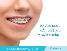 LƯU Ý CẦN BIẾT KHI NIỀNG RĂNG