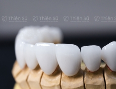 Răng Sứ Thẩm Mỹ